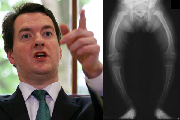 'I will develop rickets to connect with working class' - The Poke