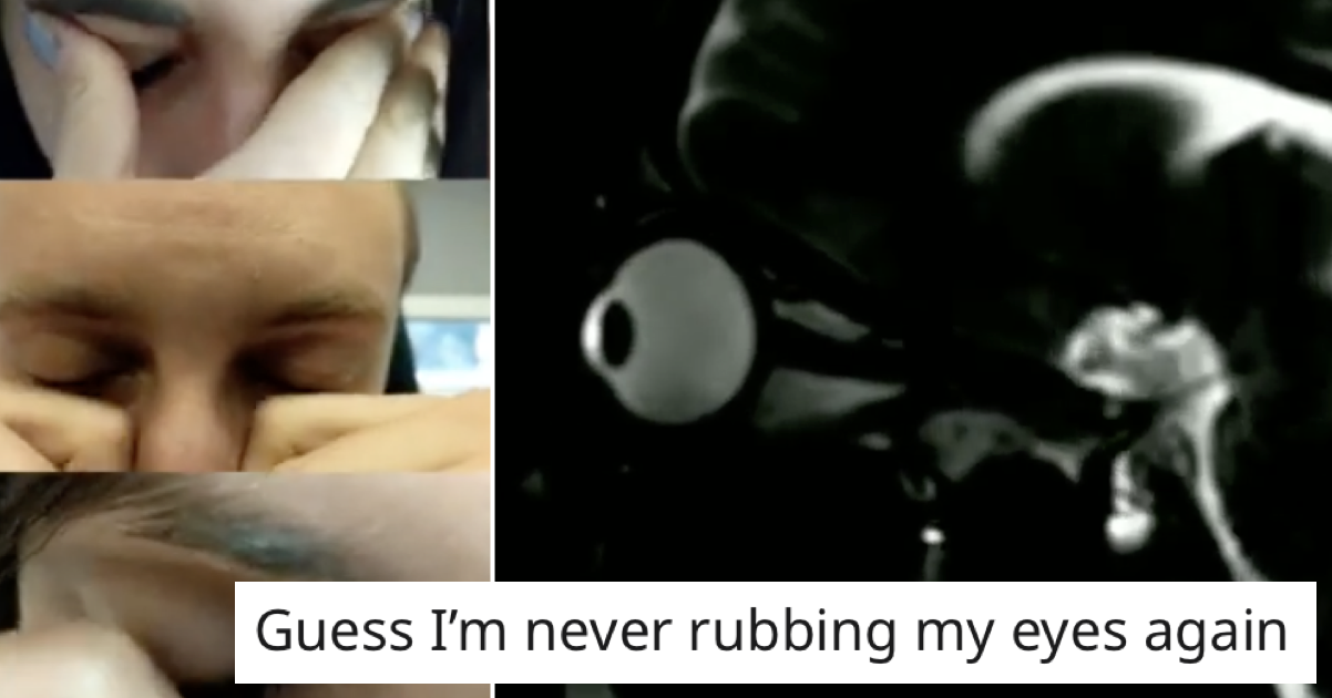 This MRI scan of what happens when you rub your eyes is a proper eye