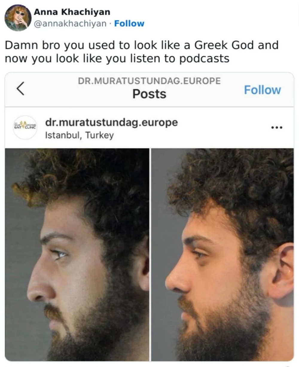 Side photos of a man before and after a nose job.
Text - Damn bro you used to look like a Greek God and now you look like you listen to podcasts
